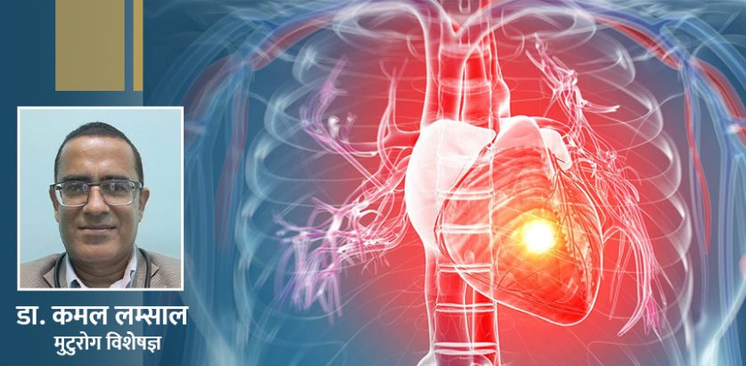 निदाएको बेला पनि हुन सक्छ ‘हार्ट अट्याक’