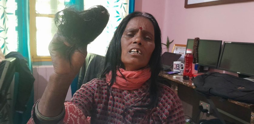 छिमेकीले मारपीट गर्दै कपाल उखेले, न्याय दिने कोहि छैन