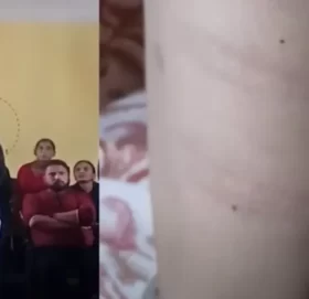 शिद्धार्थ शिशु सदन सिकाइमा ‘छडी’को प्रयोग, शिक्षिकाको कुटाइटले विद्यार्थीको ज्वरो फुट्यो