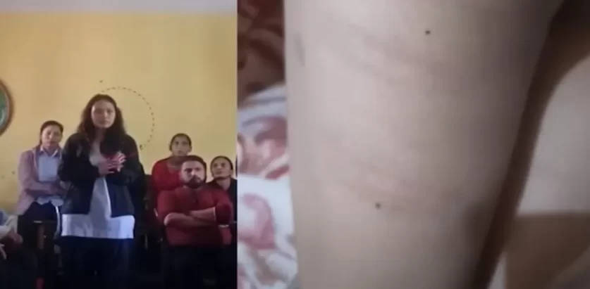 शिद्धार्थ शिशु सदन सिकाइमा ‘छडी’को प्रयोग, शिक्षिकाको कुटाइटले विद्यार्थीको ज्वरो फुट्यो