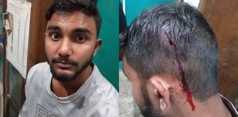 जानकी मन्दिर पछाडी एक युवकमाथि आक्रमण, टाउकोमा फाईटर प्रहार