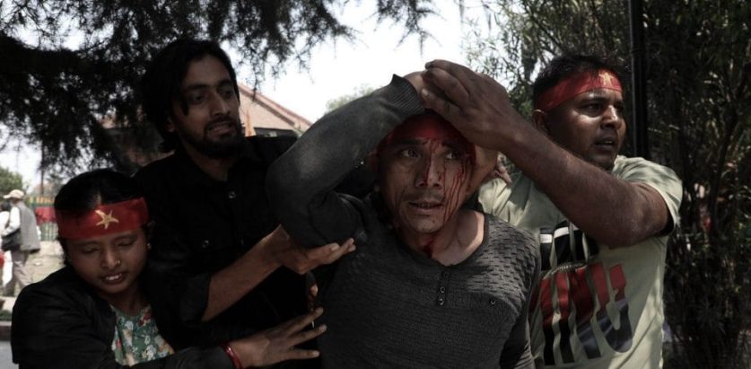 प्रहरीले अन्धाधुन्ध लाठी चलाउँदा दर्जनौँ मिटरब्याज पीडित घाइते (तस्बिरसहित)