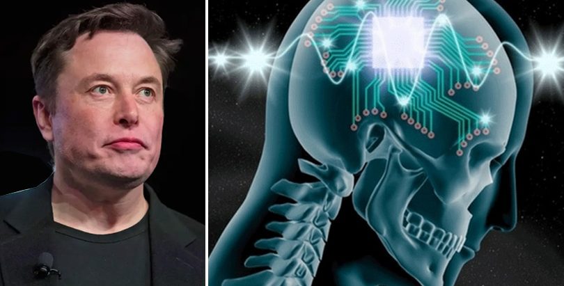 दिमागमा ’चिप’ राखेर परीक्षण गर्न अनुमति