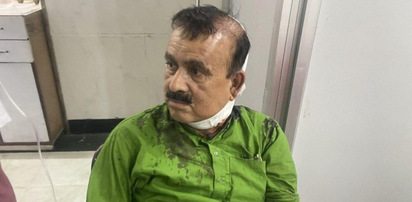 सहमहामन्त्रीमाथी भएको सांघातिक हमलामा कांग्रेसको भर्त्सना 