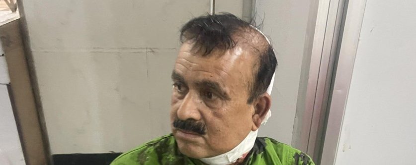 कांग्रेसका सहमहामन्त्री यादवमाथि धारिलो हतियार प्रहार