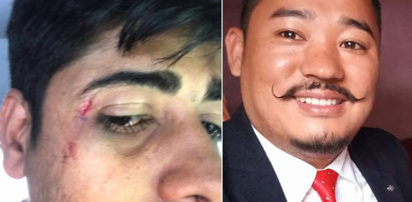 प्रशासकीय अधिकृतको कुटाइबाट कार्यालय सहयोगी घाइते