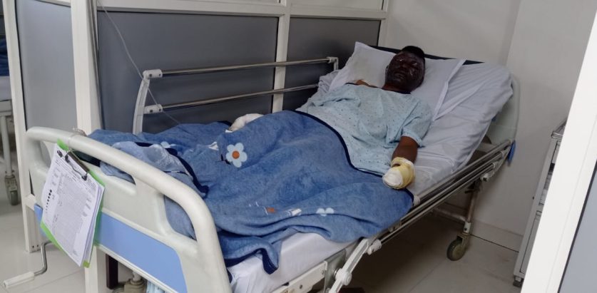 उर्लाबारी आगलागीका घाइतेको उपचारमा कोसी प्रदेश सरकारको समन्वय