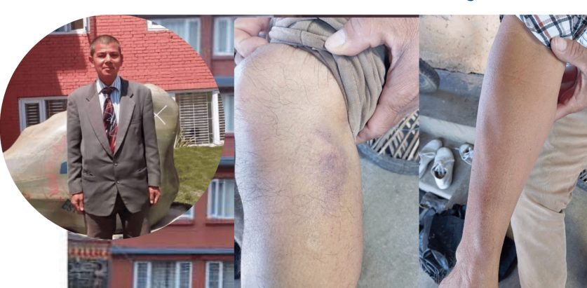 क्रिश्चियनको कलेजमा कर्मचारीमाथि कुटपिट