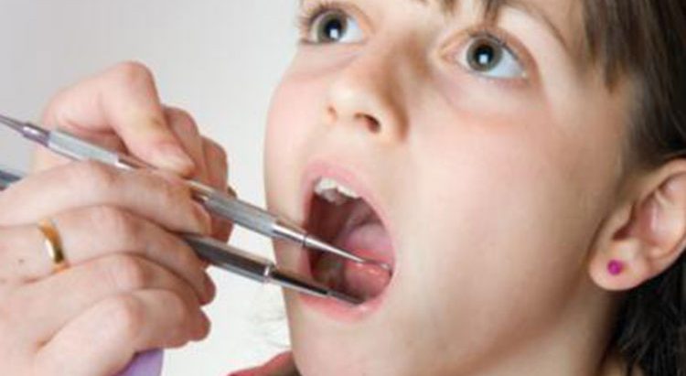 जति रोग लुकाएपनि देखाइदिन्छ जिब्रोले