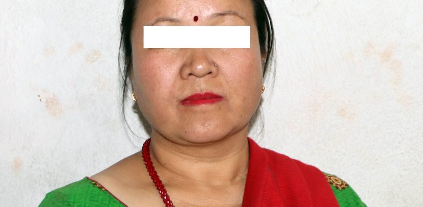 बैंकिङ कसुर मुद्दाकी फरार प्रतिवादी पक्राउ